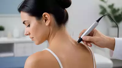 User using acupuncture device