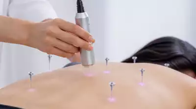 Moderne Akupunkturgeräte in Aktion