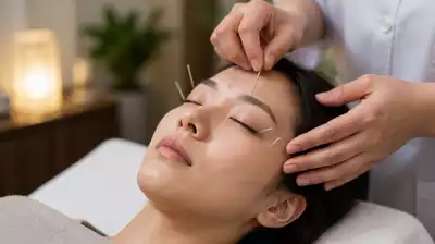 Image showing the process of acupuncture for eye health
