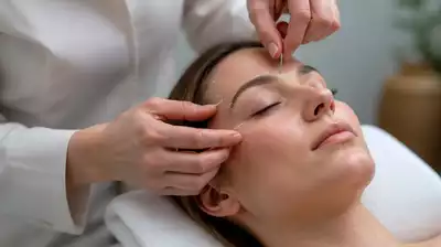 Lifestyle image of eye acupuncture treatment session